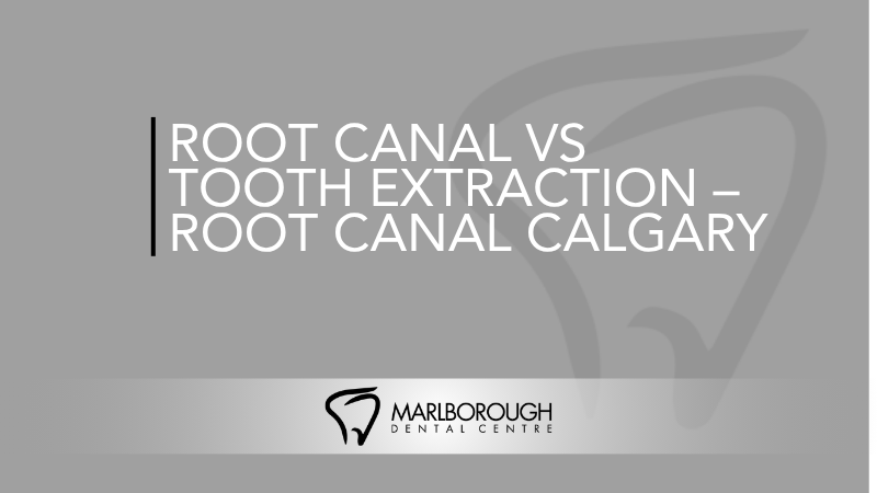 Root Canal vs Tooth Extraction – Root Canal Calgary